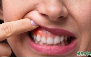 假牙是什么生肖？假牙打一个生肖