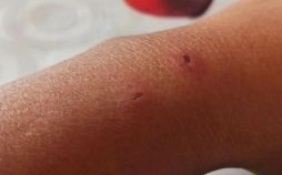 遍体鳞伤是什么生肖？遍体鳞伤打一准确生肖