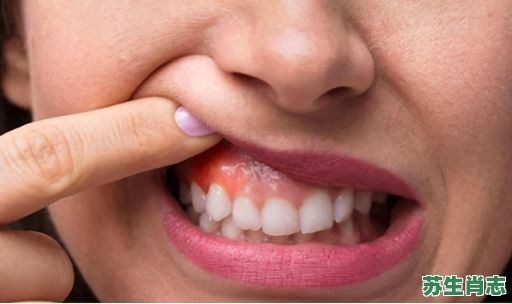 假牙是什么生肖？假牙打一个生肖