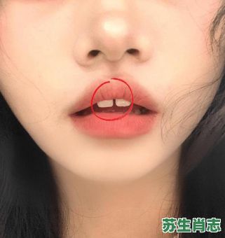 牙齿整齐的是什么生肖？牙齿松动怎么办