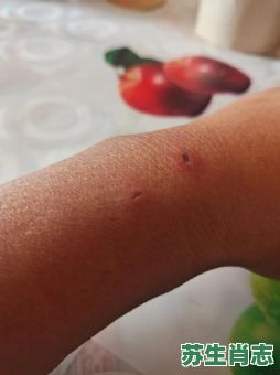 遍体鳞伤是什么生肖？遍体鳞伤打一准确生肖